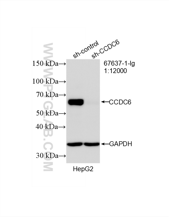 Western Blot (WB) analysis of HepG2 cells using CCDC6 Monoclonal antibody (67637-1-Ig)