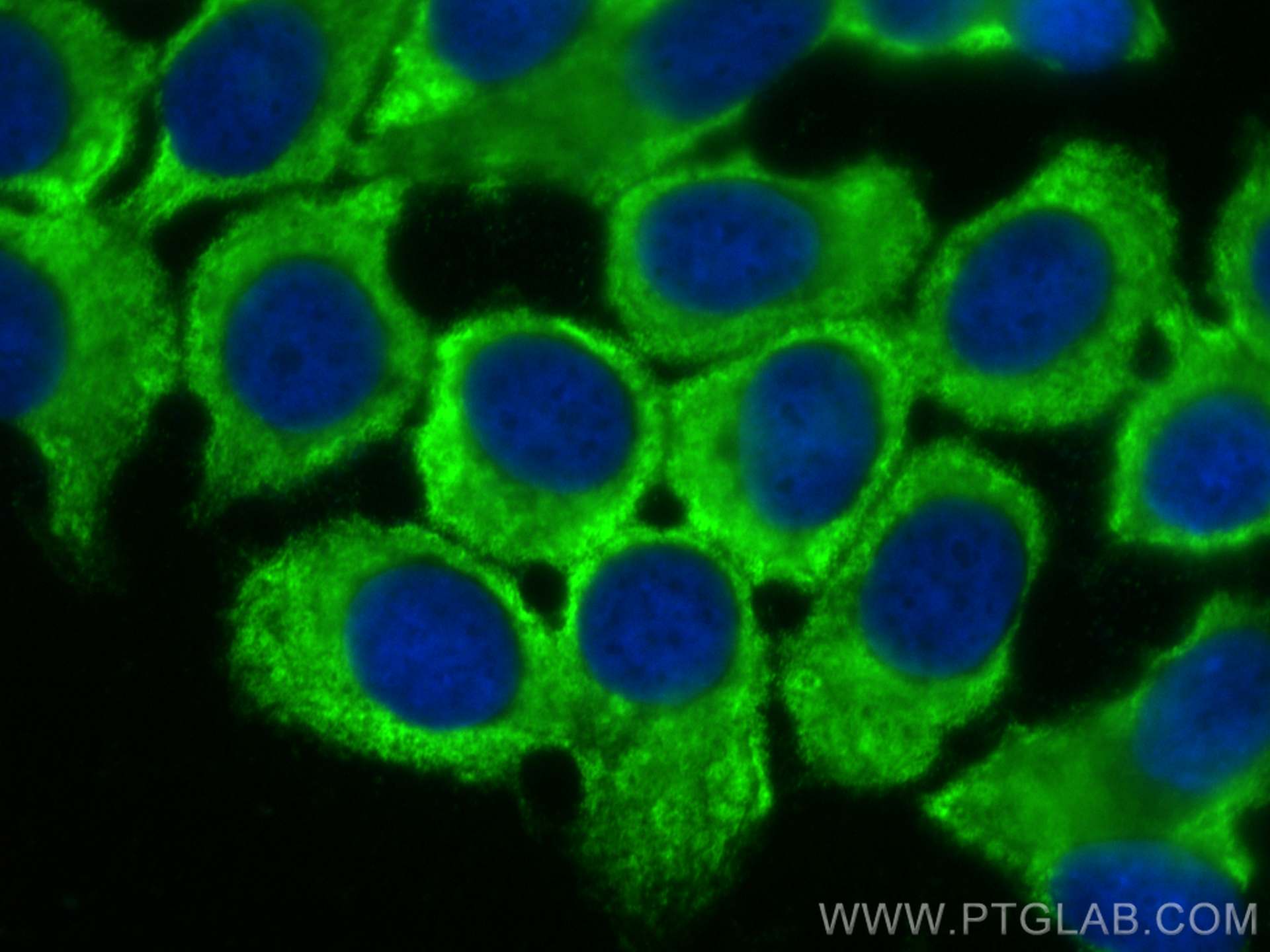 Immunofluorescence (IF) / fluorescent staining of MCF-7 cells using CoraLite® Plus 488-conjugated CCDC6 Monoclonal ant (CL488-67637)