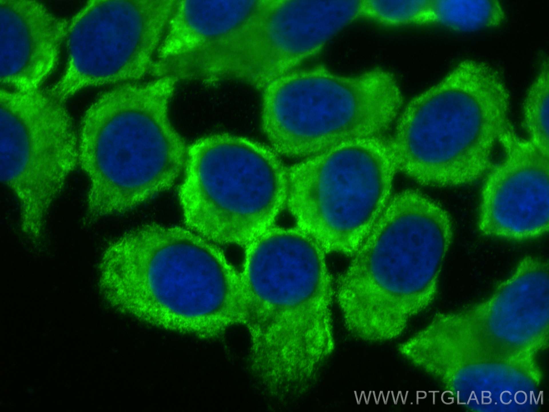 IF Staining of MCF-7 using CL488-67637