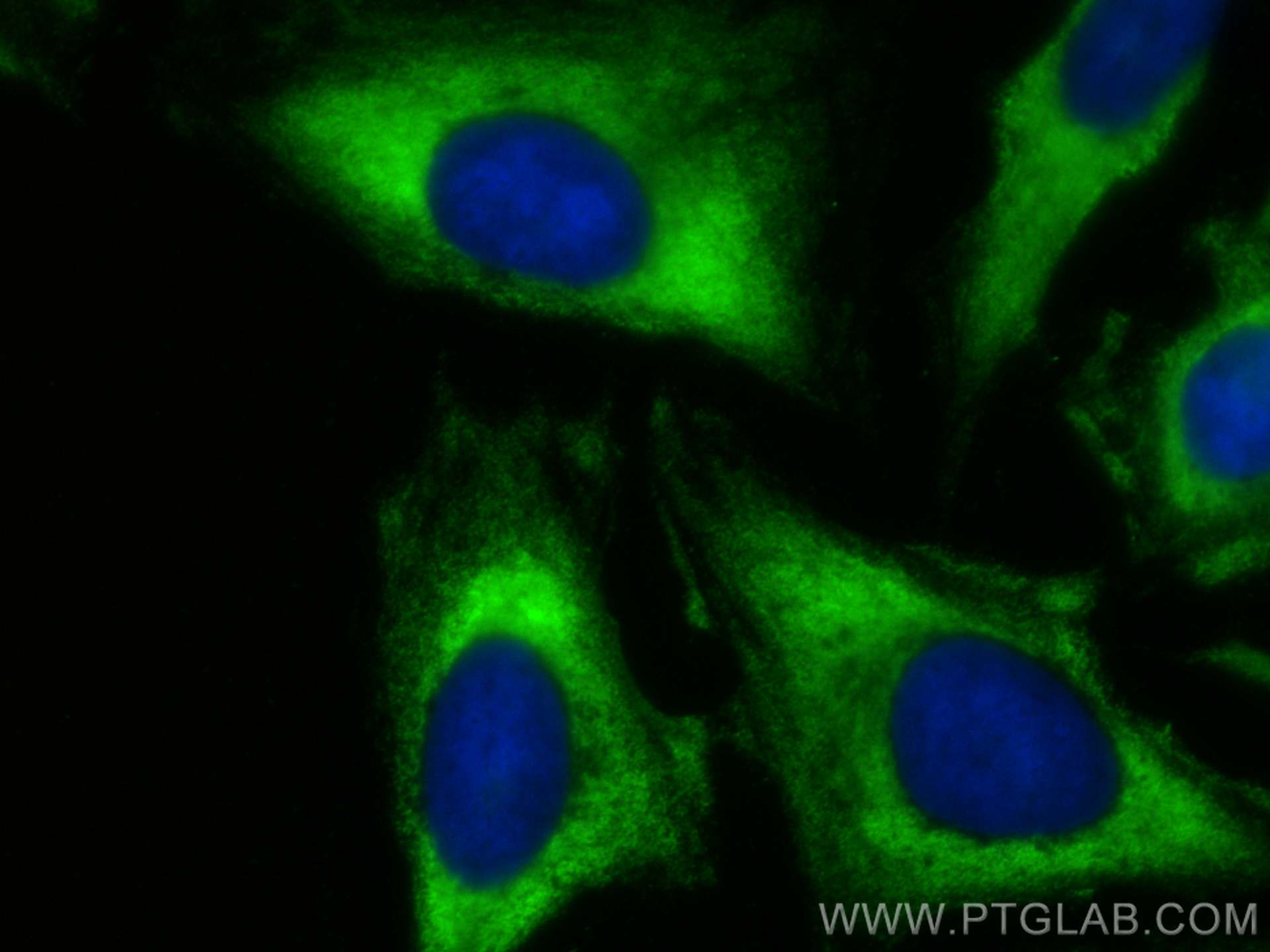 Immunofluorescence (IF) / fluorescent staining of U2OS cells using CoraLite® Plus 488-conjugated CCDC6 Monoclonal ant (CL488-67637)