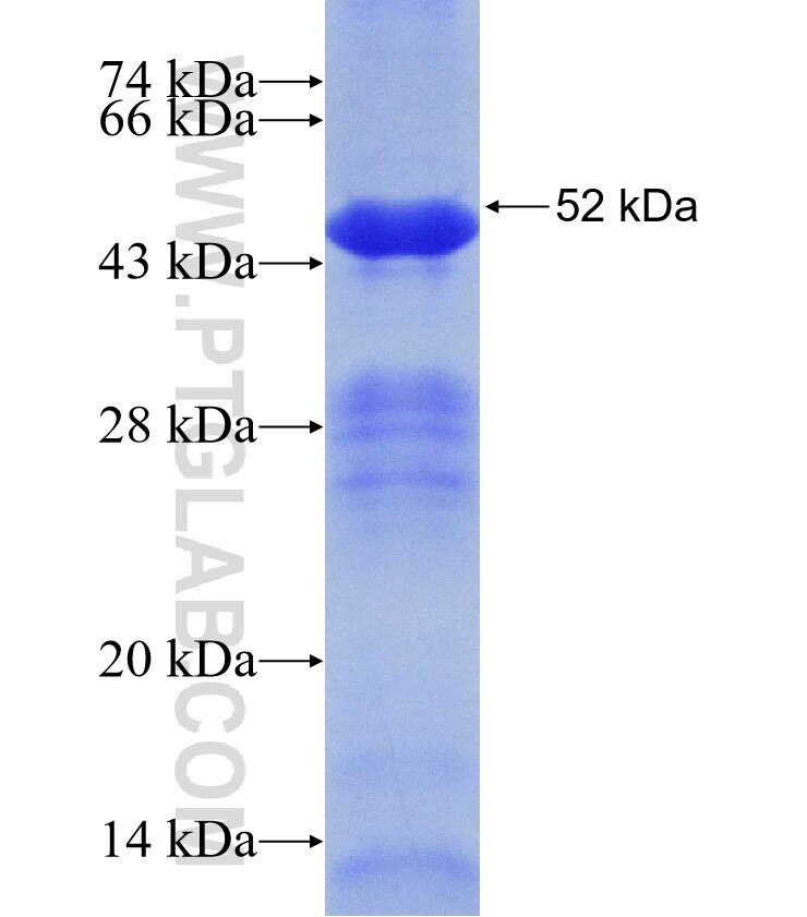 CCDC6 fusion protein Ag6952 SDS-PAGE
