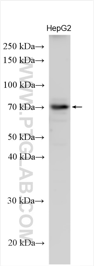 Western Blot (WB) analysis of various lysates using CCDC60 Polyclonal antibody (28652-1-AP)