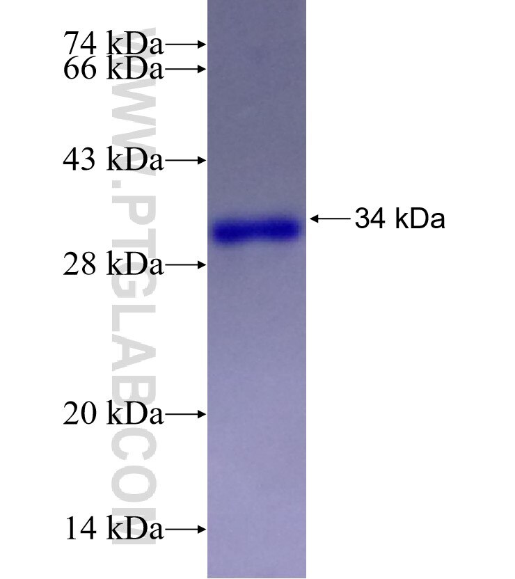 CCDC60 fusion protein Ag28109 SDS-PAGE