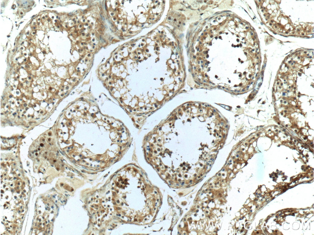 Immunohistochemistry (IHC) staining of human testis tissue using CCDC62 Polyclonal antibody (25981-1-AP)