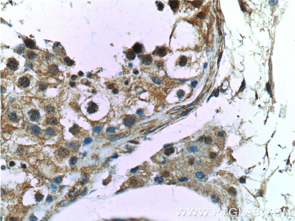 Immunohistochemistry (IHC) staining of human testis tissue using CCDC62 Polyclonal antibody (25981-1-AP)