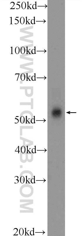Western Blot (WB) analysis of mouse testis tissue using CCDC62 Polyclonal antibody (25981-1-AP)