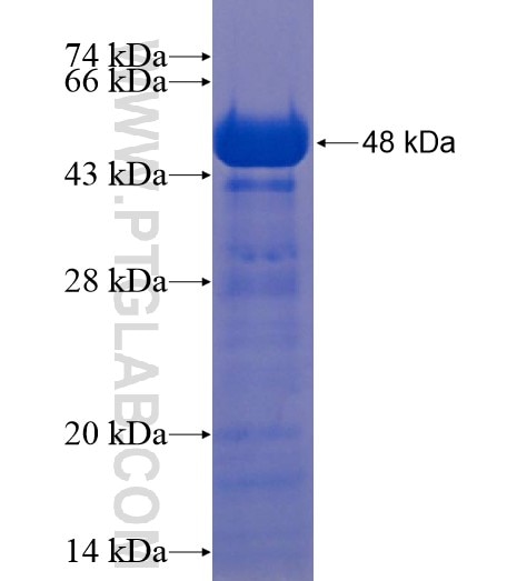 CCDC62 fusion protein Ag22043 SDS-PAGE