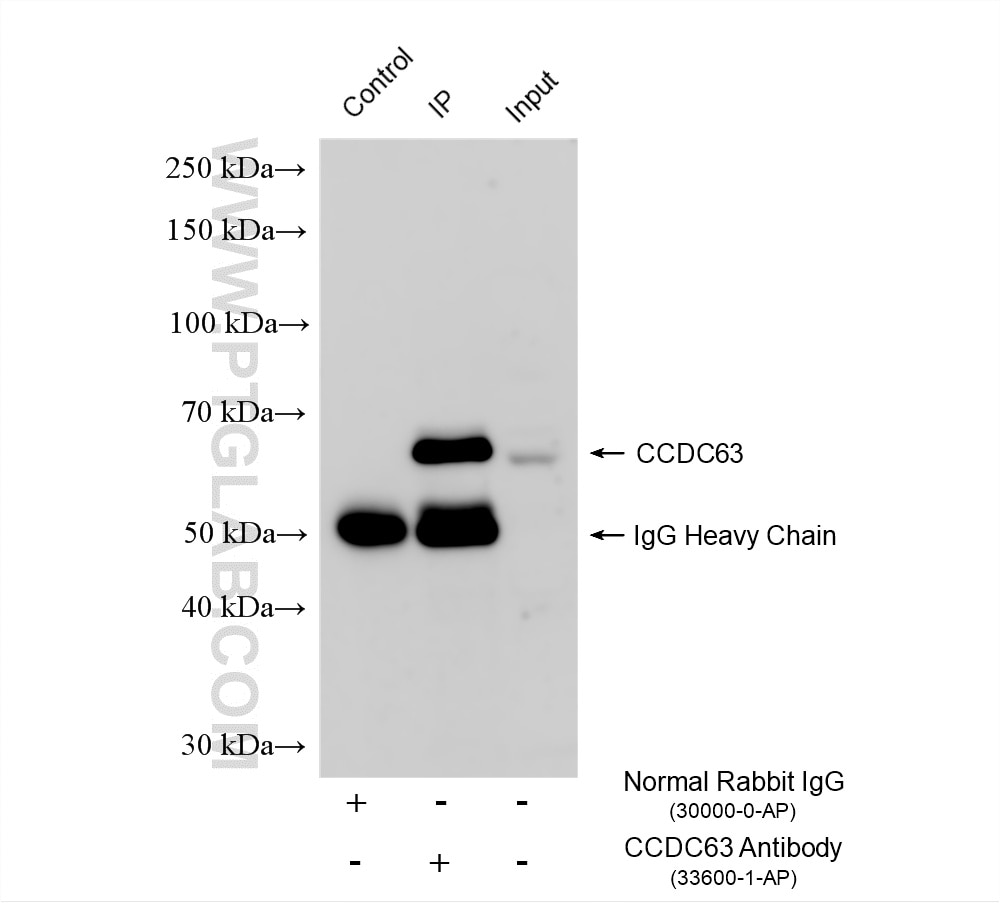 Immunoprecipitation (IP) experiment of mouse testis tissue using CCDC63 Polyclonal antibody (33600-1-AP)