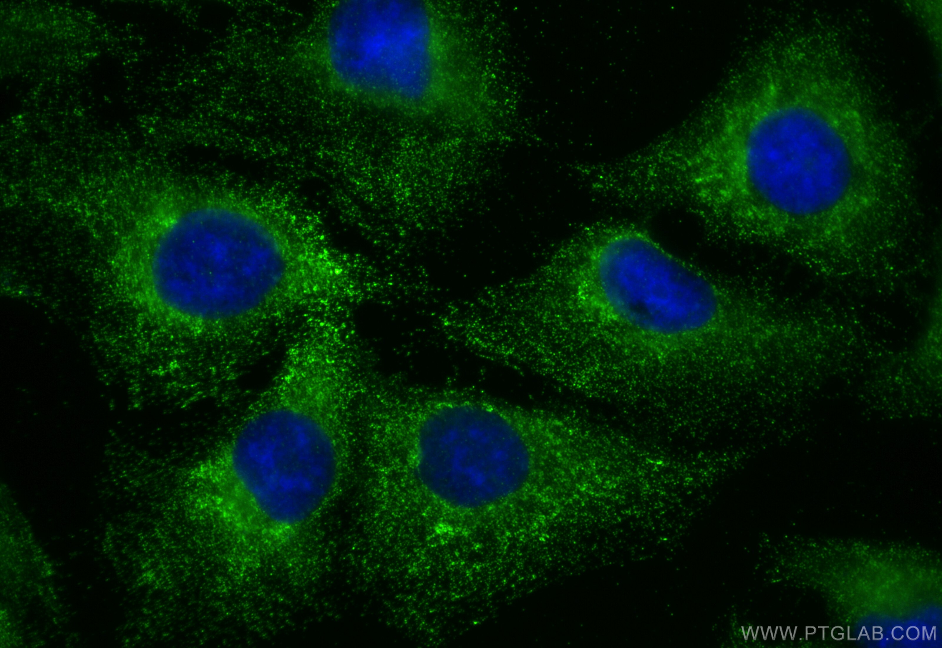 Immunofluorescence (IF) / fluorescent staining of U2OS cells using CCDC65 Polyclonal antibody (24376-1-AP)