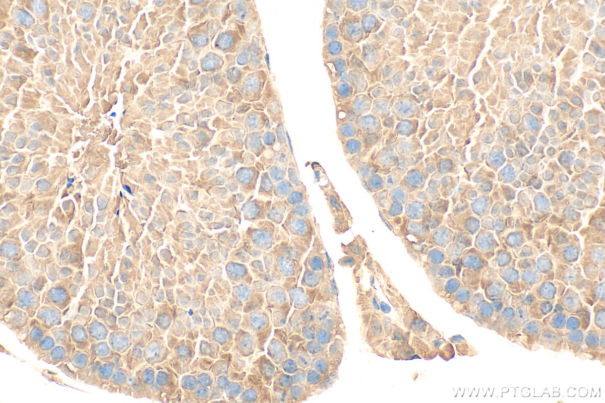 Immunohistochemistry (IHC) staining of mouse testis tissue using CCDC65 Polyclonal antibody (24376-1-AP)