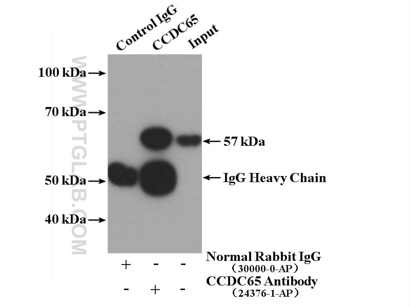 Immunoprecipitation (IP) experiment of mouse testis tissue using CCDC65 Polyclonal antibody (24376-1-AP)