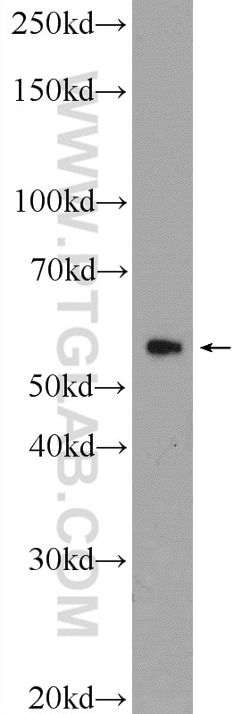 Western Blot (WB) analysis of mouse testis tissue using CCDC65 Polyclonal antibody (24376-1-AP)