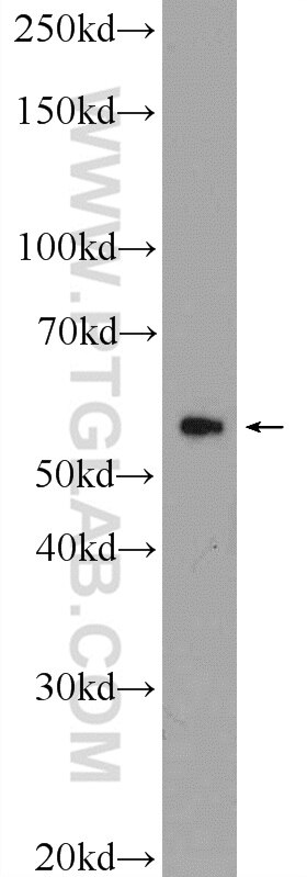 WB analysis of mouse testis using 24376-1-AP