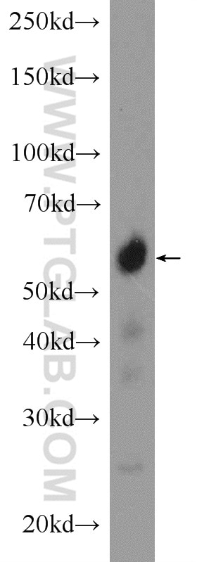 Western Blot (WB) analysis of rat testis tissue using CCDC65 Polyclonal antibody (24376-1-AP)