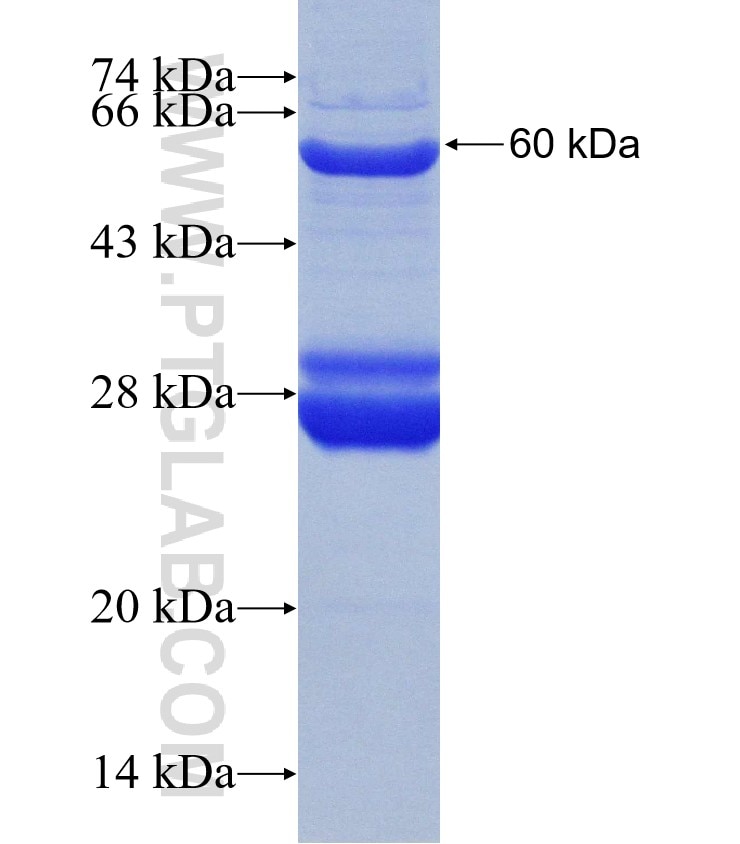 CCDC65 fusion protein Ag19357 SDS-PAGE