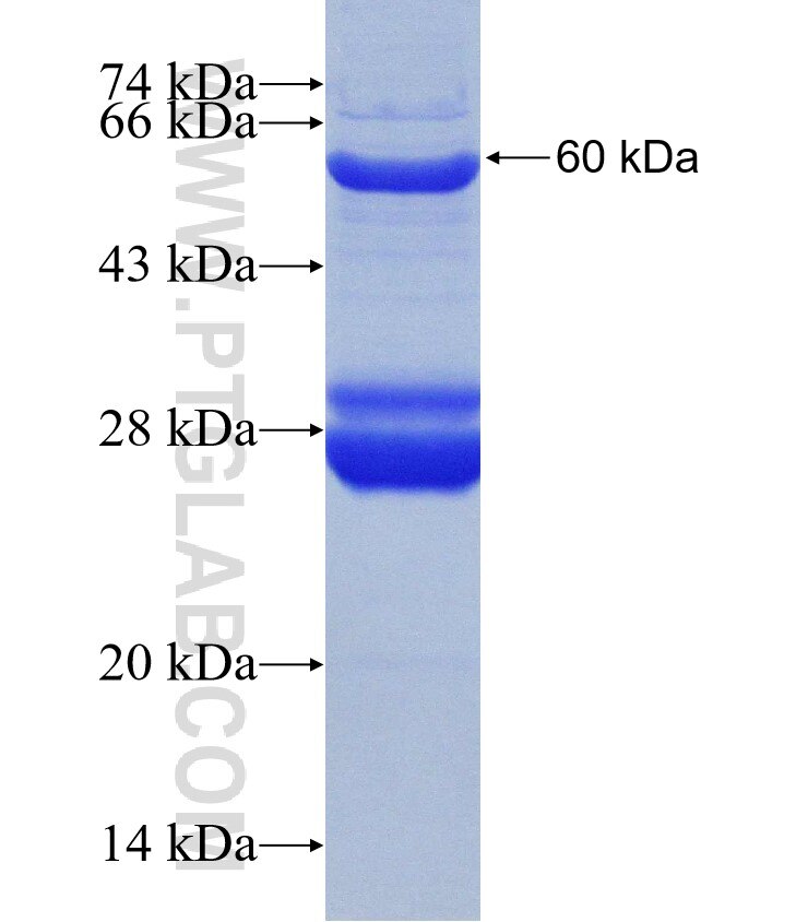 CCDC65 fusion protein Ag19357 SDS-PAGE