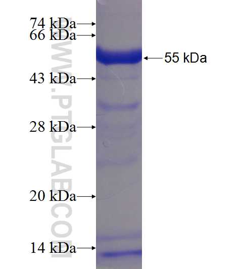 CCDC66 fusion protein Ag23432 SDS-PAGE