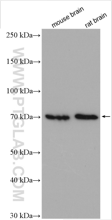 Western Blot (WB) analysis of various lysates using CCDC67 Polyclonal antibody (24579-1-AP)