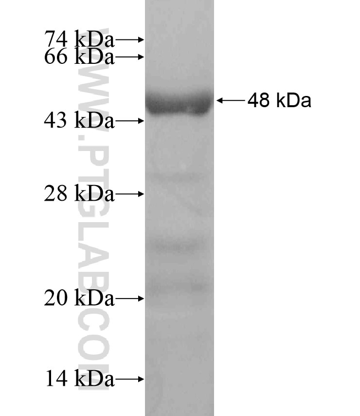 CCDC67 fusion protein Ag18358 SDS-PAGE