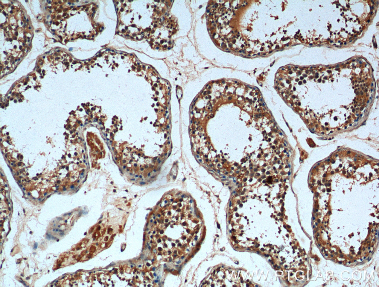 Immunohistochemistry (IHC) staining of human testis tissue using CCDC68 Polyclonal antibody (26301-1-AP)