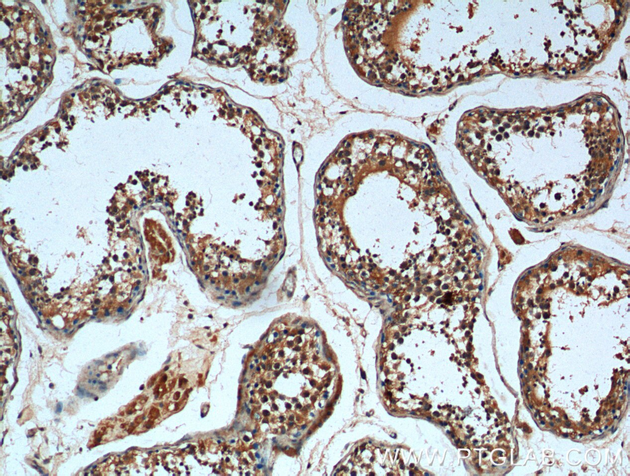 IHC staining of human testis using 26301-1-AP