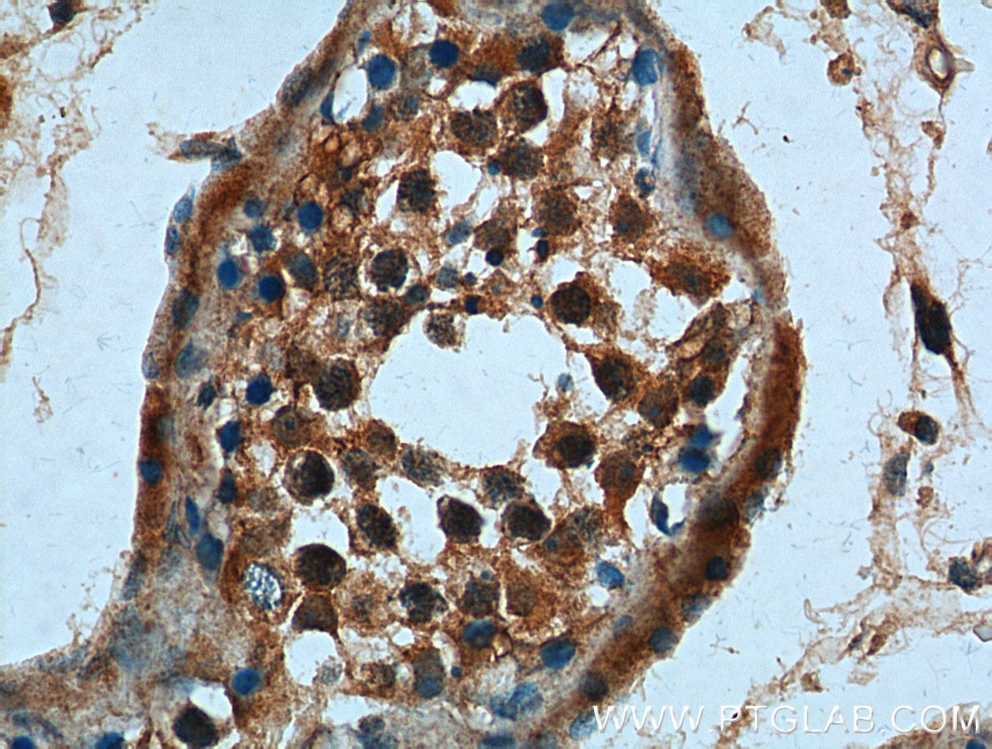 Immunohistochemistry (IHC) staining of human testis tissue using CCDC68 Polyclonal antibody (26301-1-AP)
