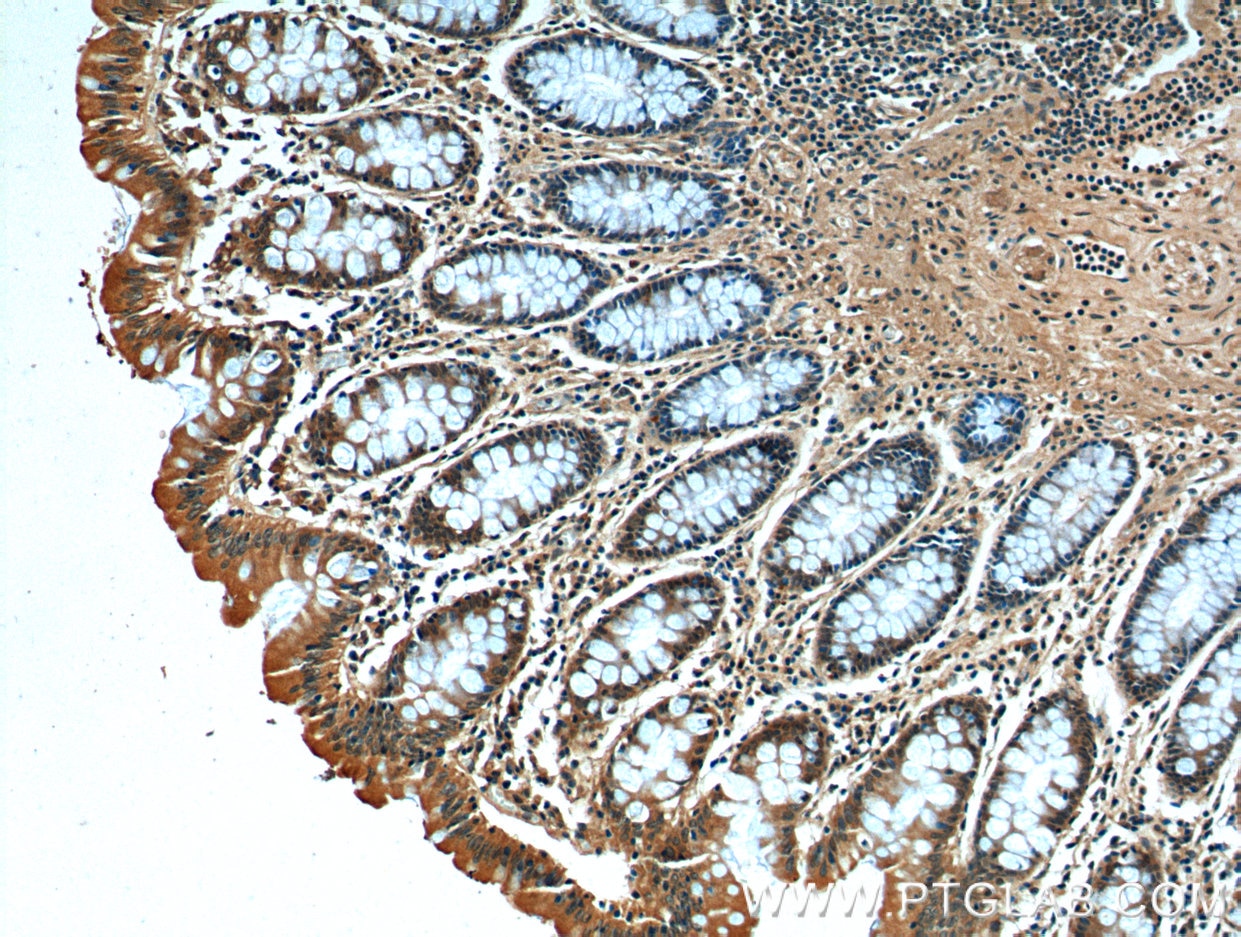 Immunohistochemistry (IHC) staining of human colon tissue using CCDC68 Polyclonal antibody (26301-1-AP)