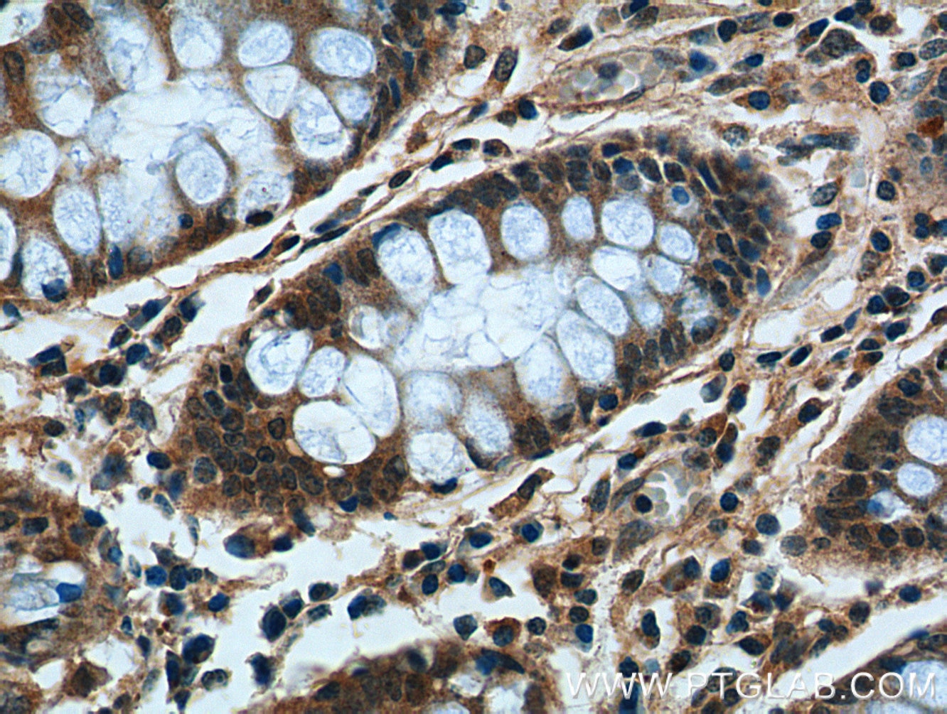 Immunohistochemistry (IHC) staining of human colon tissue using CCDC68 Polyclonal antibody (26301-1-AP)