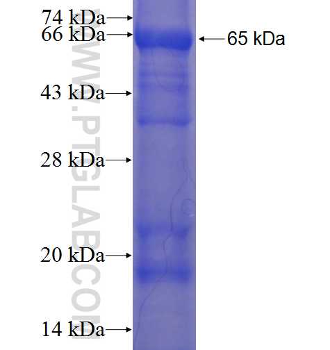 CCDC68 fusion protein Ag23622 SDS-PAGE