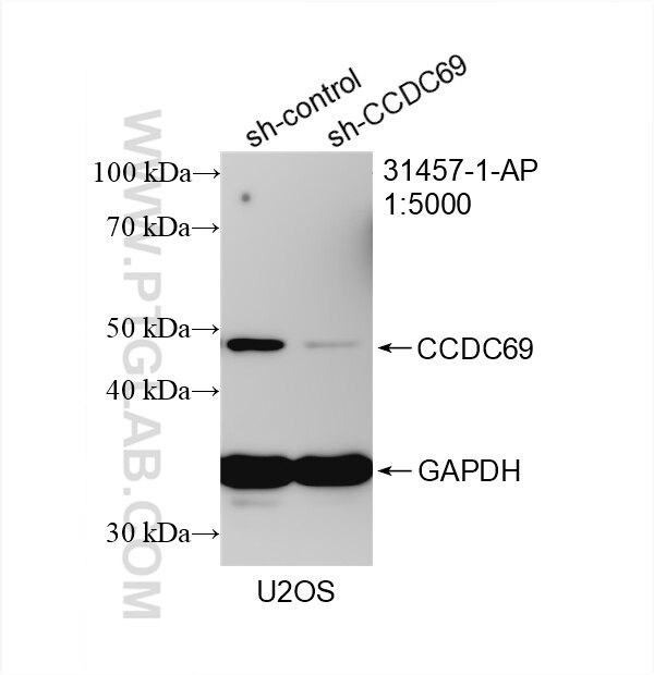 Western Blot (WB) analysis of U2OS cells using CCDC69 Polyclonal antibody (31457-1-AP)
