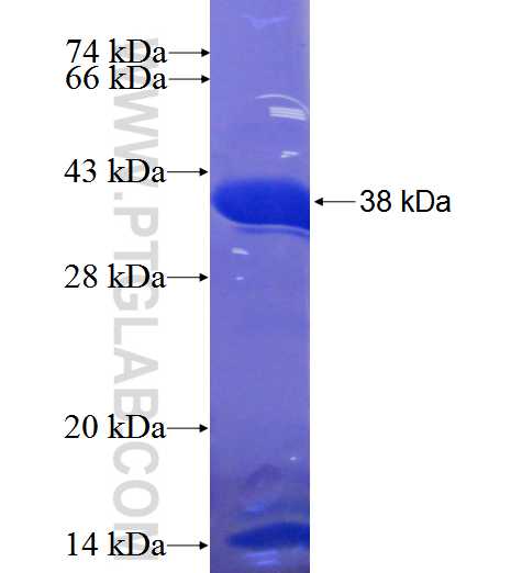 CCDC7 fusion protein Ag23761 SDS-PAGE