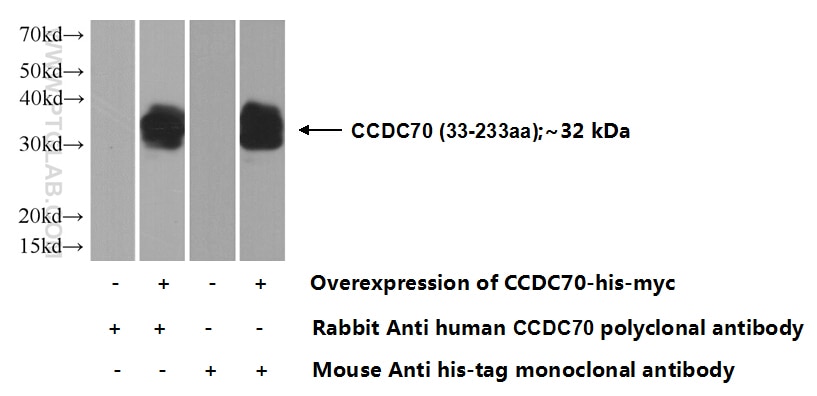Western Blot (WB) analysis of Transfected HEK-293 cells using CCDC70 Polyclonal antibody (21558-1-AP)