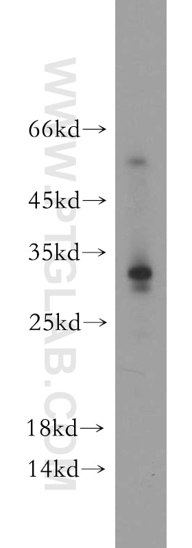 Western Blot (WB) analysis of HepG2 cells using CCDC70 Polyclonal antibody (21558-1-AP)