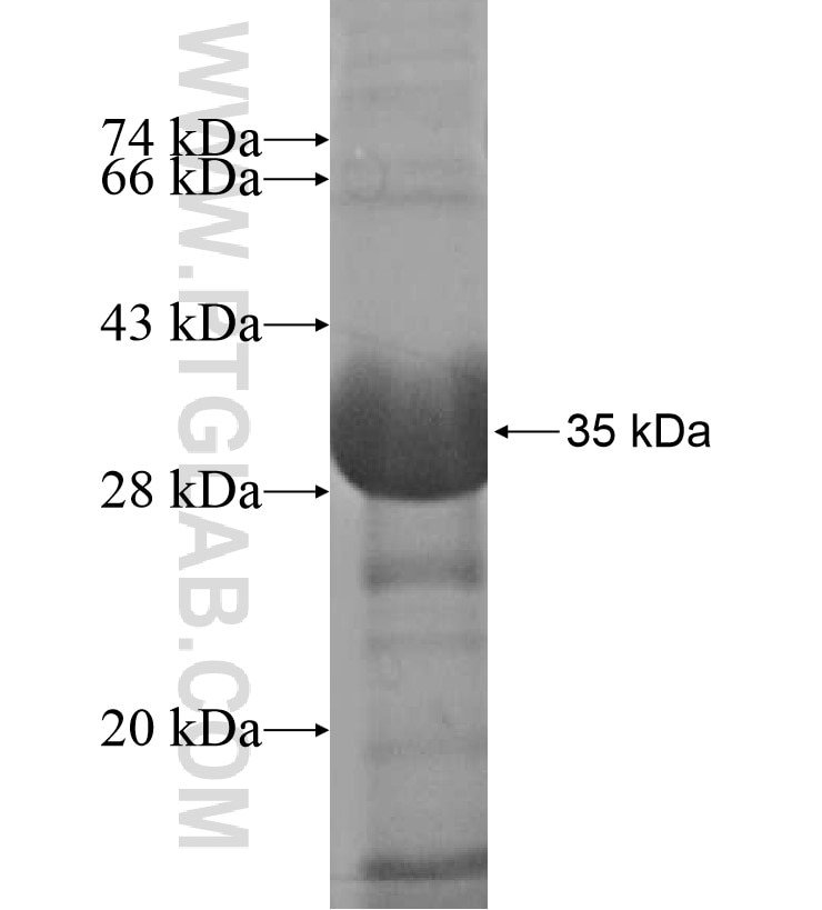 CCDC70 fusion protein Ag16531 SDS-PAGE