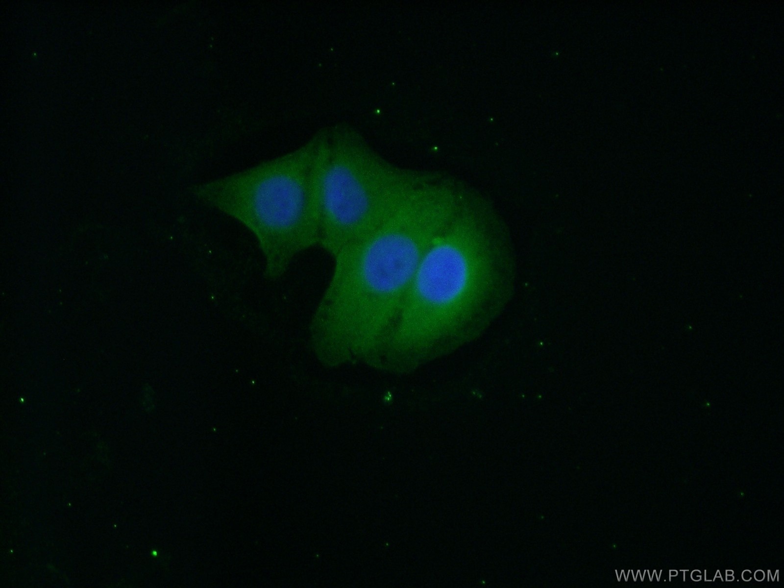 Immunofluorescence (IF) / fluorescent staining of A549 cells using CCDC72 Polyclonal antibody (20393-1-AP)