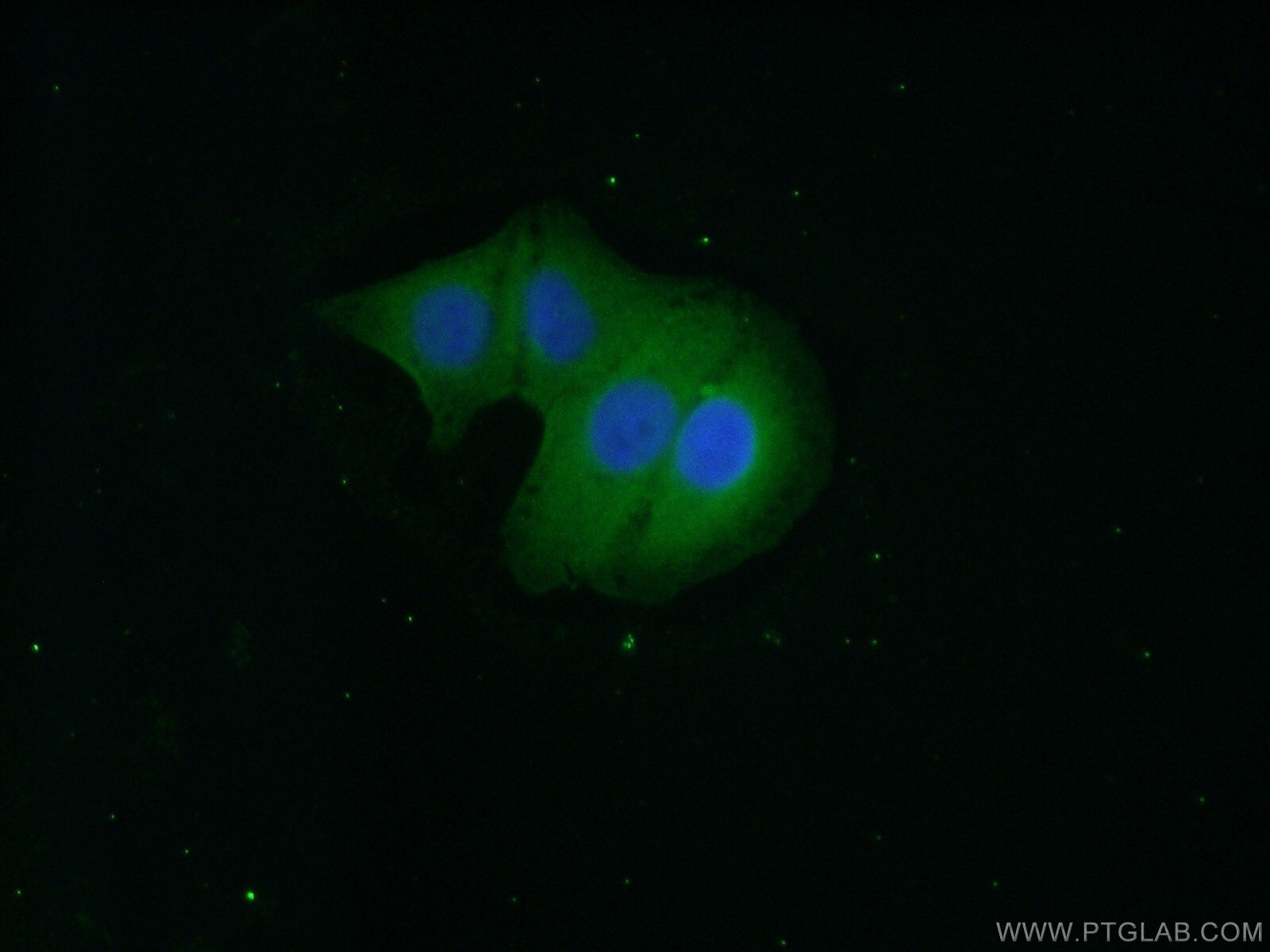 IF Staining of A549 using 20393-1-AP