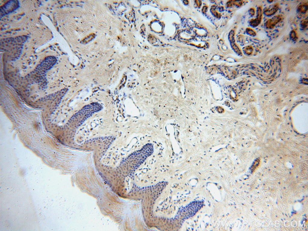 Immunohistochemistry (IHC) staining of human skin tissue using CCDC72 Polyclonal antibody (20393-1-AP)