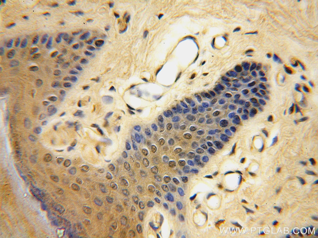 Immunohistochemistry (IHC) staining of human skin tissue using CCDC72 Polyclonal antibody (20393-1-AP)