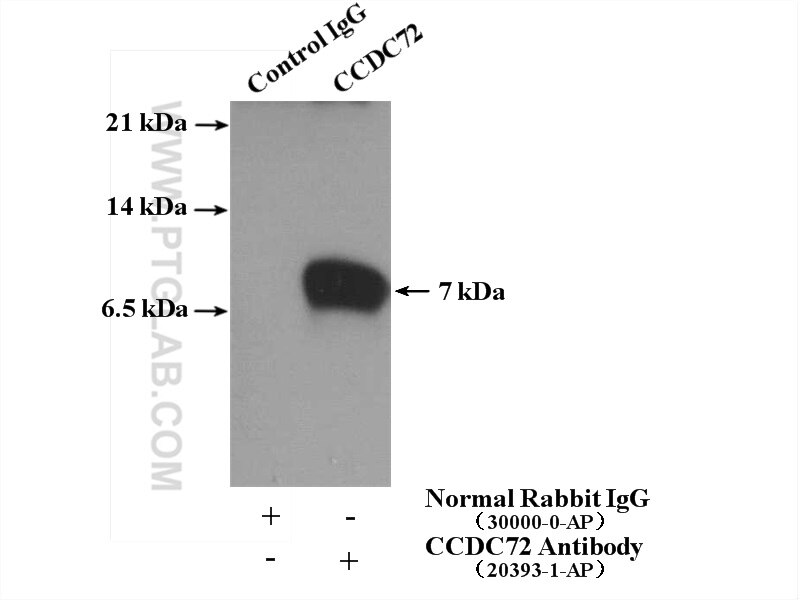 Immunoprecipitation (IP) experiment of A549 cells using CCDC72 Polyclonal antibody (20393-1-AP)