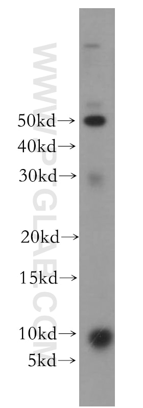 Western Blot (WB) analysis of MCF-7 cells using CCDC72 Polyclonal antibody (20393-1-AP)