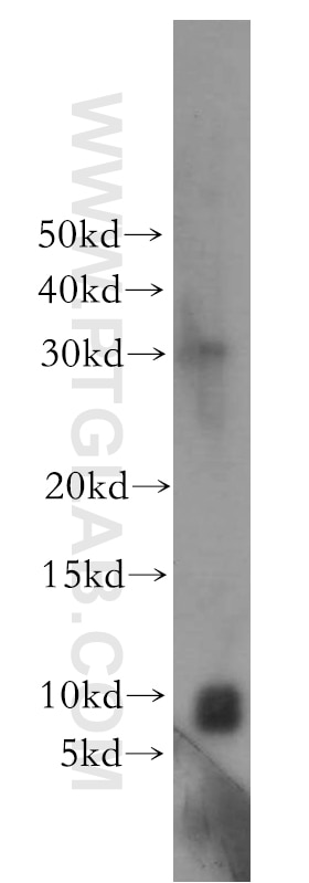 Western Blot (WB) analysis of A549 cells using CCDC72 Polyclonal antibody (20393-1-AP)