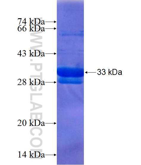 CCDC72 fusion protein Ag13792 SDS-PAGE
