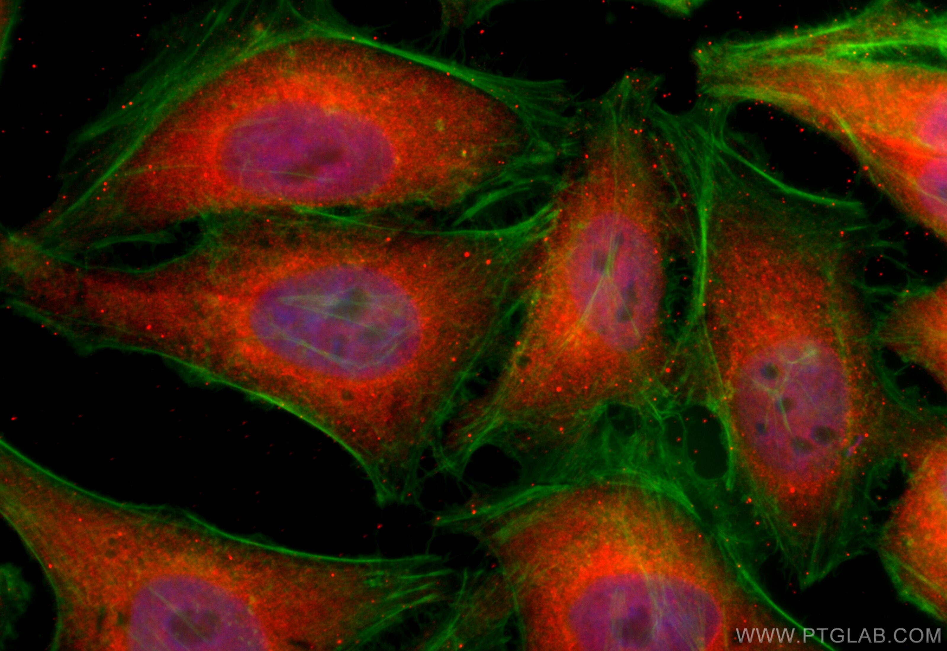 Immunofluorescence (IF) / fluorescent staining of HeLa cells using CCDC76 Polyclonal antibody (31484-1-AP)