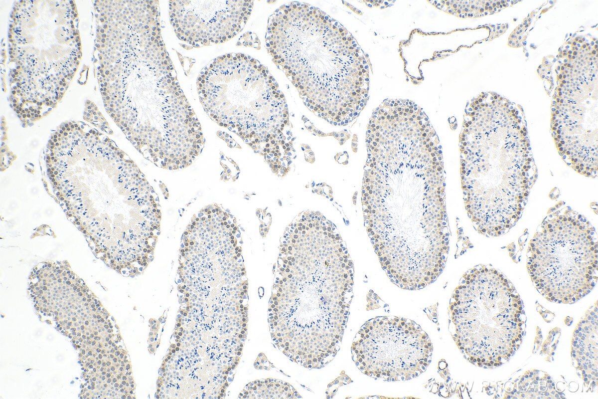 Immunohistochemistry (IHC) staining of mouse testis tissue using CCDC76 Polyclonal antibody (31484-1-AP)