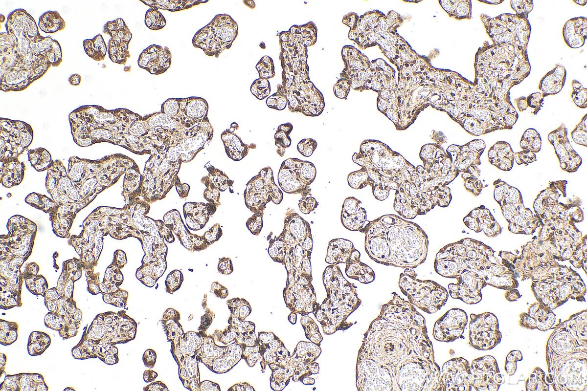 Immunohistochemistry (IHC) staining of human placenta tissue using CCDC76 Polyclonal antibody (31484-1-AP)
