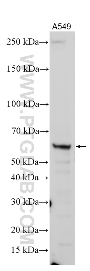 Western Blot (WB) analysis of various lysates using CCDC77 Polyclonal antibody (26369-1-AP)