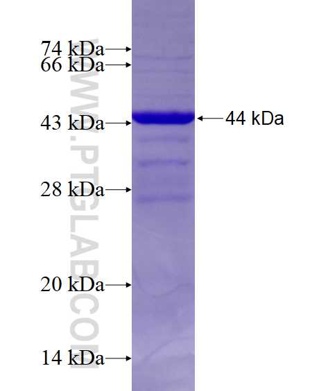 CCDC77 fusion protein Ag14691 SDS-PAGE