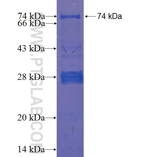 CCDC78 fusion protein Ag23161 SDS-PAGE