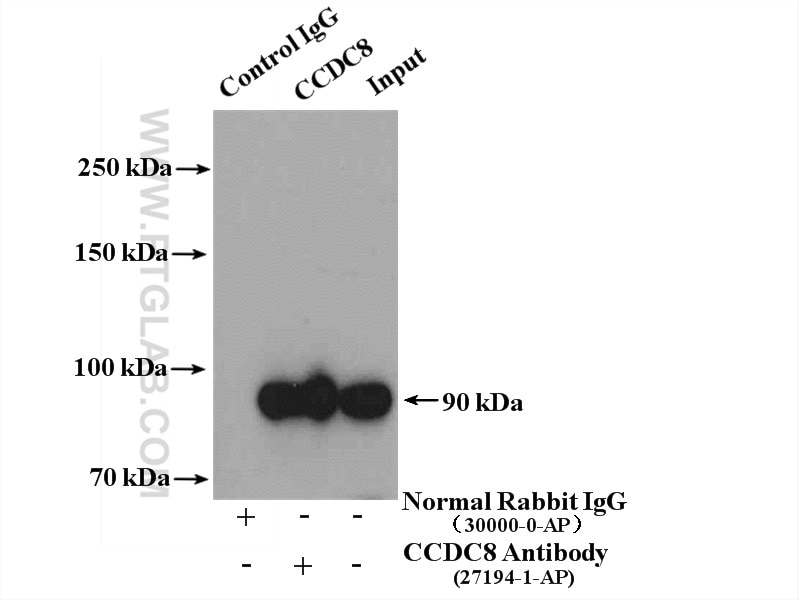 Immunoprecipitation (IP) experiment of HEK-293 cells using CCDC8 Polyclonal antibody (27194-1-AP)