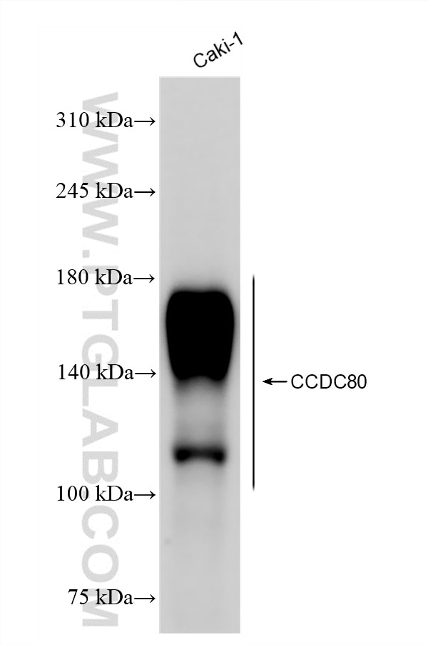 WB analysis of Caki-1 using 87731-2-RR (same clone as 87731-2-PBS) Western Blot (WB) analysis of Caki-1 cells using CCDC80 Recombinant monoclonal antibody (87731-2-RR)